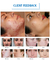 10.2in شاشة Pdt Light Therapy Facial Equipment Photodynamic Light Therapy Home Pdt